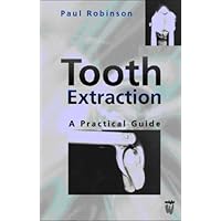 Tooth Extraction: A Practical Guide Tooth Extraction: A Practical Guide Paperback