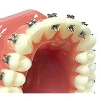 10 pieces Dentalmall Lingual rest Bite Turbos Openner Bondable Hinge Tongue Crib Tongue Tamers