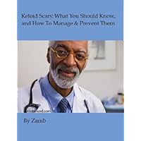 Keloid Scars: What You Should Know, and How To Manage & Prevent Them Keloid Scars: What You Should Know, and How To Manage & Prevent Them Kindle