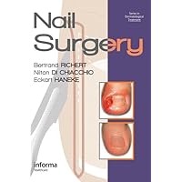 Nail Surgery (Series in Dermatological Treatment) Nail Surgery (Series in Dermatological Treatment) Hardcover