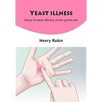 Yeast illness: Basics of yeasts affecting women genital area