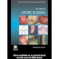 An Atlas of Atopic Eczema (Encyclopedia of Visual Medicine Series Book 71) An Atlas of Atopic Eczema (Encyclopedia of Visual Medicine Series Book 71) Kindle Hardcover