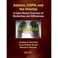 Asthma, COPD, and Overlap: A Case-Based Overview of Similarities and Differences Asthma, COPD, and Overlap: A Case-Based Overview of Similarities and Differences Paperback Kindle Hardcover