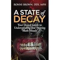A State of Decay: Your Dental Guide to Understanding and Treating 