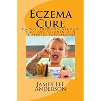Eczema Cure: Causes, Triggers, Vaccine Caution, Vitamin D, & Probiotic Supplements by James Lee Anderson (2014-06-01)
