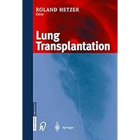 Lung Transplantation Lung Transplantation Kindle Paperback