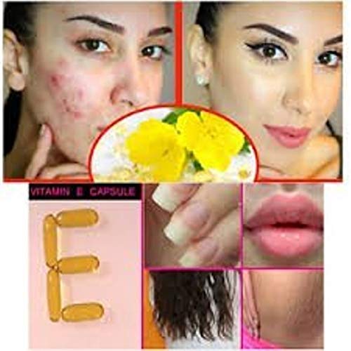 Mua Evion 400 MG Vitamin E Capsule for Face, Hair, Pimple, Glowing Skin,  Dark Circles, Skin Whitening & Control Hair Loss – 200 Capsules trên Amazon  Mỹ chính hãng 2023 | Giaonhan247