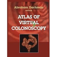 Atlas of Virtual Colonoscopy Atlas of Virtual Colonoscopy Kindle Hardcover Paperback