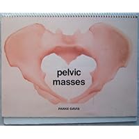 Pelvic masses