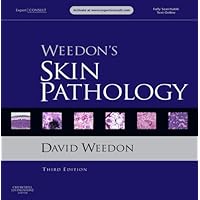Weedon's Skin Pathology: Expert Consult - Online and Print Weedon's Skin Pathology: Expert Consult - Online and Print Kindle Hardcover