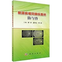 Diabetic retinopathy prevention and treatment(Chinese Edition)