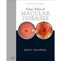 Gass' Atlas of Macular Diseases: 2-Volume Set - Expert Consult: Online and Print Gass' Atlas of Macular Diseases: 2-Volume Set - Expert Consult: Online and Print Kindle Hardcover