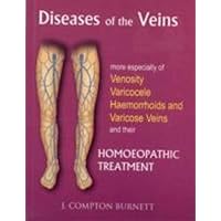 Diseases of the Veins: More Especilly of Venosity, Varicocele, Hemmorrhoids & Varicose Veins & Their Homoeopathic Treatment by James Compton Burnett (2012-08-01) Diseases of the Veins: More Especilly of Venosity, Varicocele, Hemmorrhoids & Varicose Veins & Their Homoeopathic Treatment by James Compton Burnett (2012-08-01) Mass Market Paperback