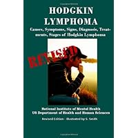 Hodgkin Lymphoma: Causes, Symptoms, Signs, Diagnosis, Treatments, Stages of Hodgkin Lymphoma