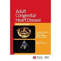 Adult Congenital Heart Disease: A Practical Guide Adult Congenital Heart Disease: A Practical Guide Kindle Paperback