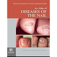 An Atlas of Diseases of the Nail (Encyclopedia of Visual Medicine Series Book 61) An Atlas of Diseases of the Nail (Encyclopedia of Visual Medicine Series Book 61) Kindle Hardcover
