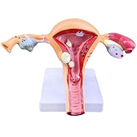 Uterus Ovary Pathology Anatomical Model Female Uterine Vaginal Lesion Model Human Reproductive System Genital Organ Teaching Tool for Medical Demonstration