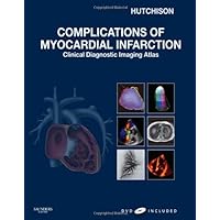 Complications of Myocardial Infarction: Clinical Diagnostic Imaging Atlas with DVD Complications of Myocardial Infarction: Clinical Diagnostic Imaging Atlas with DVD Hardcover