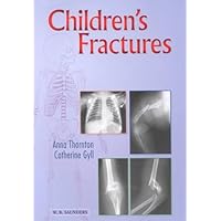 Children's Fractures: A Radiological Guide to Safe Practice Children's Fractures: A Radiological Guide to Safe Practice Paperback