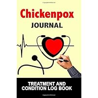 Chickenpox Journal: Treatment and Condition Log Book, 150 College-ruled Pages