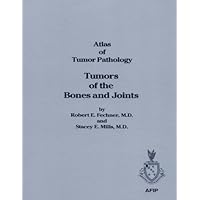 Tumors of Bones and Joints (ATLAS OF TUMOR PATHOLOGY 3RD SERIES) Tumors of Bones and Joints (ATLAS OF TUMOR PATHOLOGY 3RD SERIES) Paperback