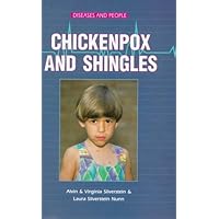 Chicken Pox and Shingles (Diseases and People) Chicken Pox and Shingles (Diseases and People) Library Binding