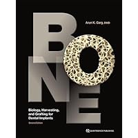 Bone: Biology, Harvesting, and Grafting for Dental Implants