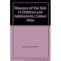 Diseases of the Skin in Children and Adolescents: Colour Atlas Diseases of the Skin in Children and Adolescents: Colour Atlas Hardcover