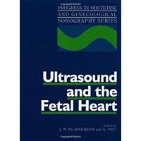 Ultrasound and the Fetal Heart (Progress in Obstetric and Gynecological Sonography Series) Ultrasound and the Fetal Heart (Progress in Obstetric and Gynecological Sonography Series) Hardcover