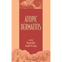 Atopic Dermatitis Atopic Dermatitis Hardcover