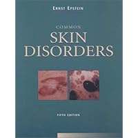 Common Skin Disorders (Book with CD-ROM) Common Skin Disorders (Book with CD-ROM) Paperback