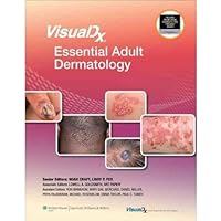 [(Visualdx: Essential Adult Dermatology)] [Author: Noah Craft] published on (April, 2010) [(Visualdx: Essential Adult Dermatology)] [Author: Noah Craft] published on (April, 2010) Hardcover
