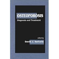 Osteoporosis: Diagnosis & Treatment Osteoporosis: Diagnosis & Treatment Hardcover