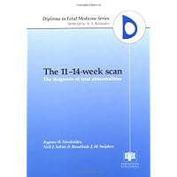 The 11-14-Week Scan: The Diagnosis of Fetal Abnormalities The 11-14-Week Scan: The Diagnosis of Fetal Abnormalities Hardcover