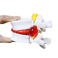 Anatomical Herniated Lumbar Vertebrae Disc Prolapse Model Human Anatomy Model White