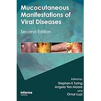 Mucocutaneous Manifestations of Viral Diseases: An Illustrated Guide to Diagnosis and Management Mucocutaneous Manifestations of Viral Diseases: An Illustrated Guide to Diagnosis and Management Hardcover