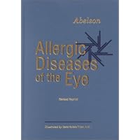 Allergic Diseases of the Eye Allergic Diseases of the Eye Hardcover