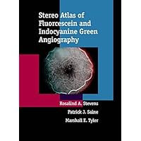 Stereo Atlas of Fluorescein and Indocyanine Green Angiography Stereo Atlas of Fluorescein and Indocyanine Green Angiography Hardcover