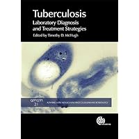 Tuberculosis: Laboratory Diagnosis and Treatment Strategies (Advances in Molecular and Cellular Microbiology Book 21) Tuberculosis: Laboratory Diagnosis and Treatment Strategies (Advances in Molecular and Cellular Microbiology Book 21) Kindle Hardcover