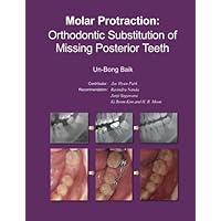 Molar Protraction:: Orthodontic Substitution of Missing Posterior Teeth Molar Protraction:: Orthodontic Substitution of Missing Posterior Teeth Paperback