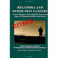 Melanoma And Other Skin Cancers: Causes, Symptoms, Signs, Diagnosis, Treatments, Stages of Melanoma and Other Skin Cancers