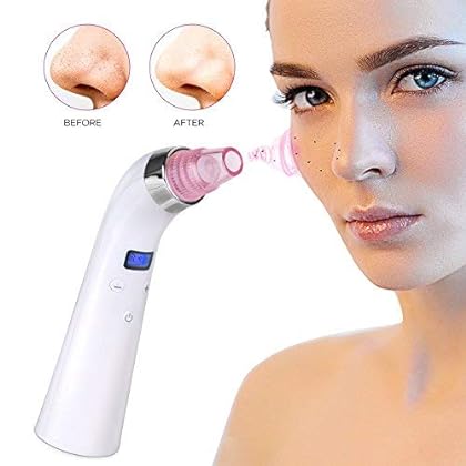 Blackhead Remover,MayBeau Rechargeable Blackhead Vacuum Removal Tool with 4 Replaceable Suction Heads and 2 Blackhead Extractor, Electric Comedo Suction Machine for All Types of Skins