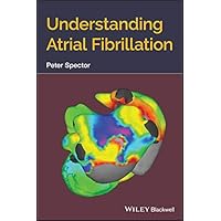 Understanding Atrial Fibrillation Understanding Atrial Fibrillation Kindle Paperback