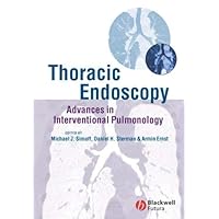 Thoracic Endoscopy: Advances in Interventional Pulmonology Thoracic Endoscopy: Advances in Interventional Pulmonology Kindle Hardcover