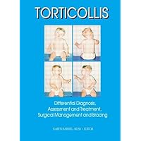 Torticollis : Differential Diagnosis, Assessment, and Treatment, Surgical Management and Bracing (for Pediatrics) Torticollis : Differential Diagnosis, Assessment, and Treatment, Surgical Management and Bracing (for Pediatrics) Paperback Kindle