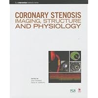 Coronary Stenosis: Imaging, Structure and Physiology Coronary Stenosis: Imaging, Structure and Physiology Hardcover