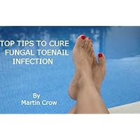 TOP TIPS TO CURE FUNGAL TOENAIL INFECTION: How to: The Treatment and Cure of Toe Nail and Fingernail Fungus and Athlete’s Foot TOP TIPS TO CURE FUNGAL TOENAIL INFECTION: How to: The Treatment and Cure of Toe Nail and Fingernail Fungus and Athlete’s Foot Kindle
