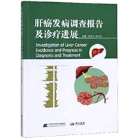 The incidence of liver cancer diagnosis and treatment and report progress(Chinese Edition)