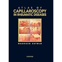 Atlas of capillaroscopy in rheumatic diseases Atlas of capillaroscopy in rheumatic diseases Kindle