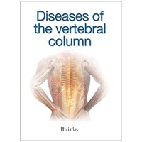 Diseases of the vertebral column Miniatlas Diseases of the vertebral column Miniatlas Kindle